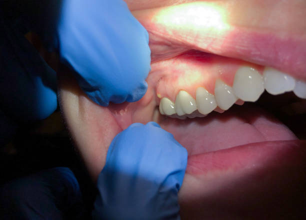 Best Emergency Dentist for Special Needs Patients in Mcalester, OK